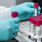 New techniques set to revolutionize liquid biopsies for cancer detection